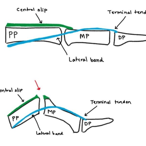 Resource hub Page 4 of 7 Merivale Hand Clinic